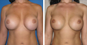 Before & After Photos